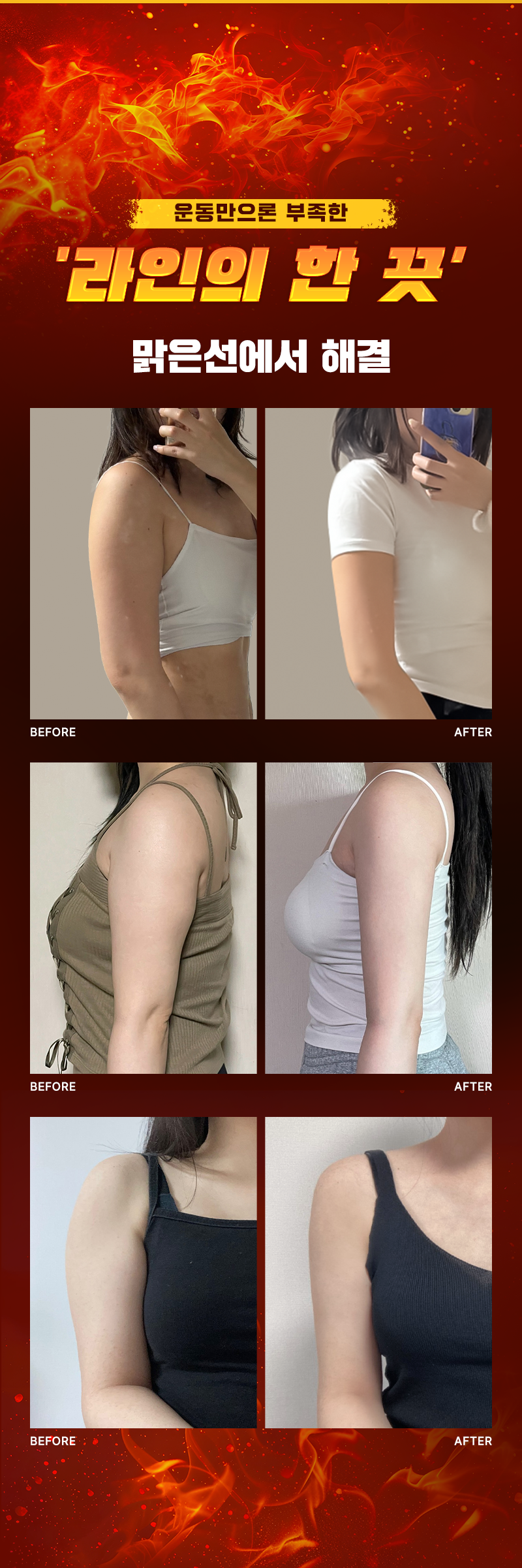 문뼈만으로 부족한 라인의 한 끗 맑은선에서 해결